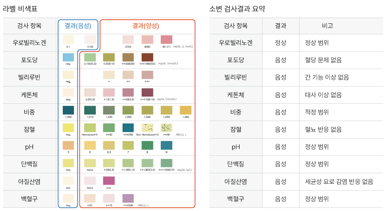 매월 정기 소변검사